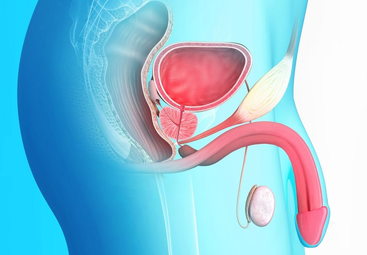les premiers symptômes d'un cancer de la prostate ?