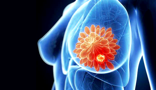 Comment on se sent quand on a un cancer ?