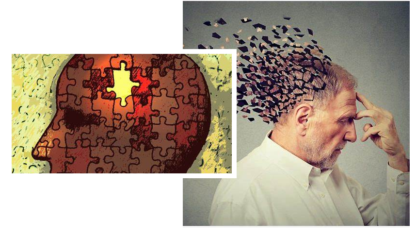 l'espérance de vie avec la maladie d'Alzheimer