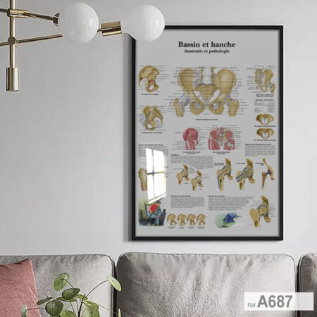 Tableau Médicale Éducative : Anatomie et pathologies Bassin et hanche, décoration cabinet Médecin ostéopathie & kinésithérapie Maroc