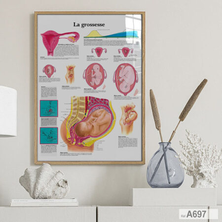Tableau Poster Médicale : anatomie de l'utérus, La grossesse, décoration cabinet médecin gynécologue - vente à Casablanca - Maroc
