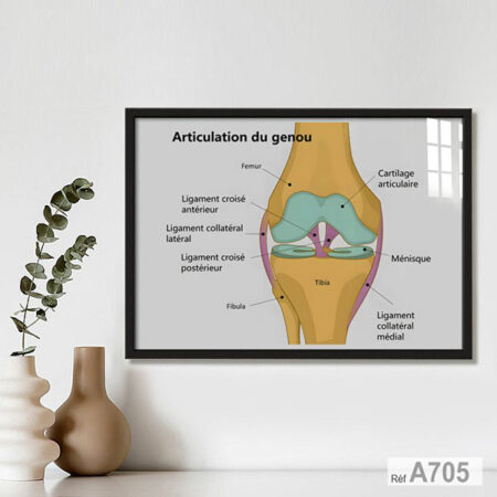 Tableaux Encadrée: Anatomie genou : Ligaments, ménisques & cartilage - Décoration Médicale cabinet, livraison vers Rabat, Tanger et tout le Maroc