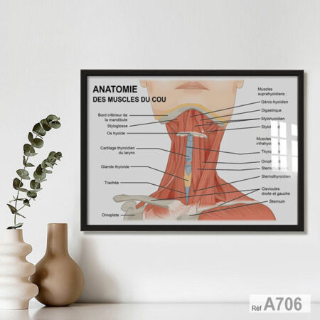 Tableaux Encadrée: Anatomie Muscles du cou,  Affiche kinésithérapie, Supra-hyoïdiens & Infra-hyoïdiens - Décor murale Médicale kiné au Maroc