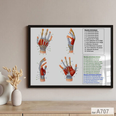 Affiche Muscles de la main : Anatomie Intrinsèques, Extrinsèques & muscles, Tableau decor cabinet medical & kinésithérapeutes