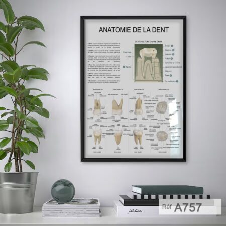 Tableau mural : Anatomie de la dent - Poster de dentiste, Decoration Cabinet Dentaire vintage, salle d'attente & réception
