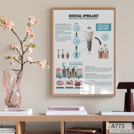 Achat Tableau Affiche d’implants dentaires: Décoration murale cabinet & clinique au Maroc Endosteal, Subpériostal, Zygomatique).
