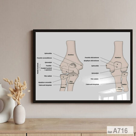 Tableau décoratif pour cabinet médical, Affiche anatomique du genou en français, pour kinésithérapeutes et professionnels de santé