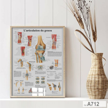 Affiche anatomique: l’articulation du genou en français, Tableau décoration murale cabinet médecin au Maroc - Les os (fémur, tibia, rotule), ligaments, ménisques et muscle