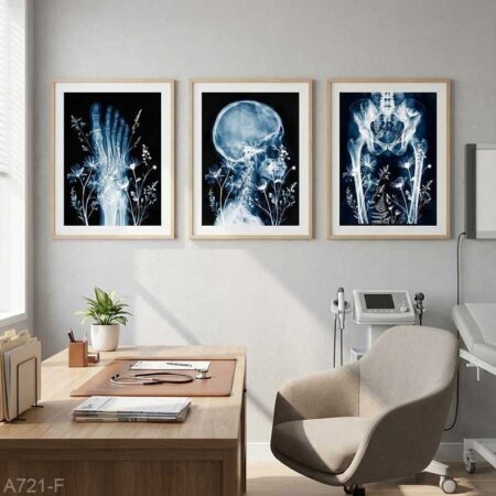 Vente Trois Tableaux Radiographie Colonne & Bassin - Déco Salle d'Attente - Rabat, Marrakech Casablanca et tout le Maroc
