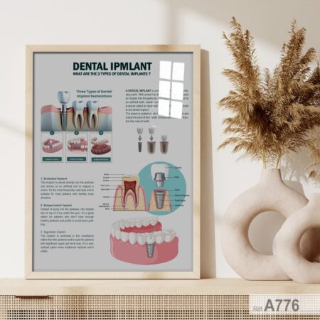 Poster Explicatif pour Cabinet dentiste sur les implants dentaires au Maroc, Tableau encadré sous vitre ملصقات عيادة الأسنان بالفرنسية في المغرب