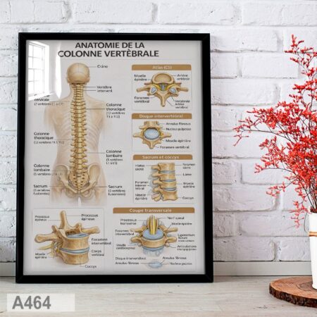 Affiche Anatomie Humaine - Colonne vertébrale, Tableau Cabinet Orthopédiste & salle d'attente Médicale